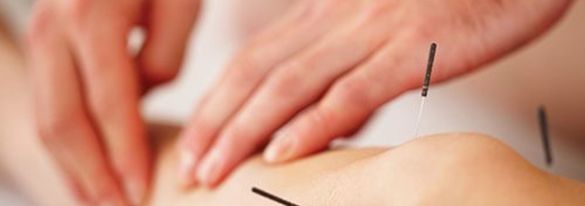azamara quest acupunture.jpg